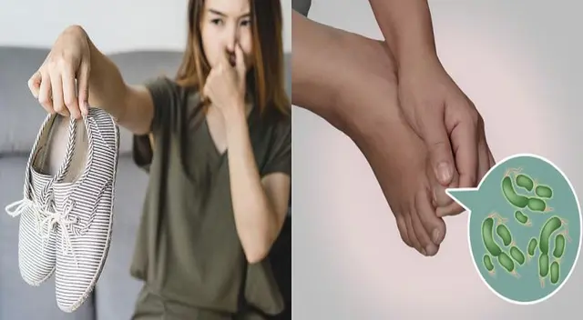 El mal olor de los pies puede resultar insoportable si no se da una buena higiene. El mal olor de los pies puede resultar insoportable si no se da una buena higiene.