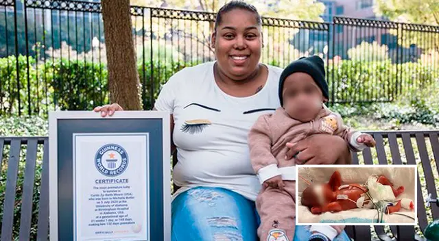 El médico tratante dijo que las estadísticas muestran que los niños que nacen tan pequeños prácticamente no tienen posibilidades de sobrevivir.