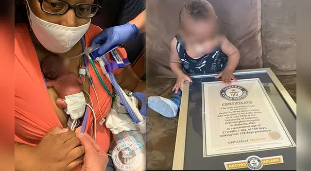 Curtis nació en julio de 2020, a las 21 semanas y un día de gestación. | Foto: composición GLR / Guinnes World Records