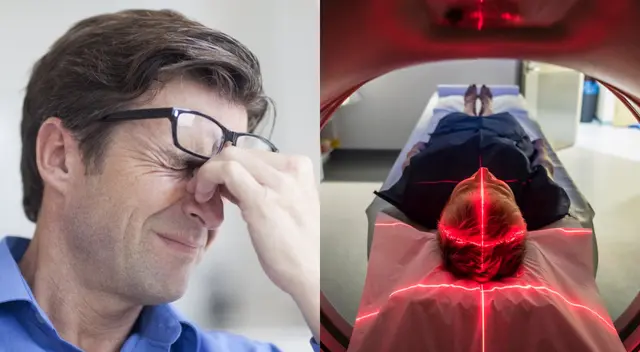 El ictus es un derrame cerebral que provoca una ruptura en una arteria del cerebro.