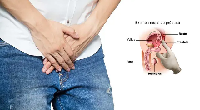 No esperes a que sea tarde, hazte tus chequeos de próstata.