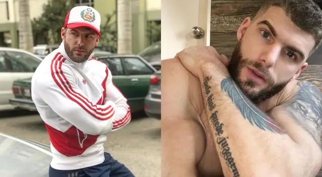 Greg Michel necesitaría otra operación por tener arterias comprometidas. Greg Michel necesitaría otra operación por tener arterias comprometidas.