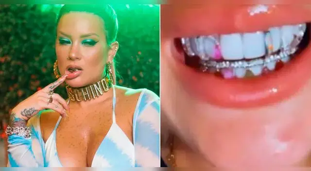 Leslie Shaw revela el precio de sus implantes dentales.