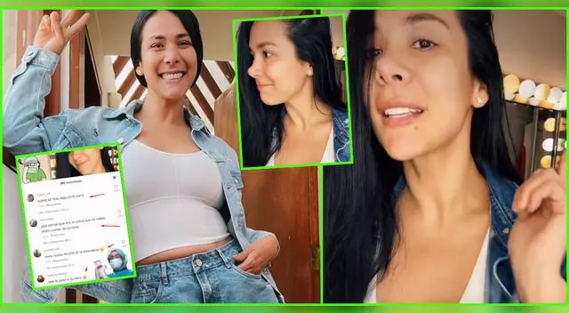 Magdyel Ugaz se habría sometido a rinoplastía.