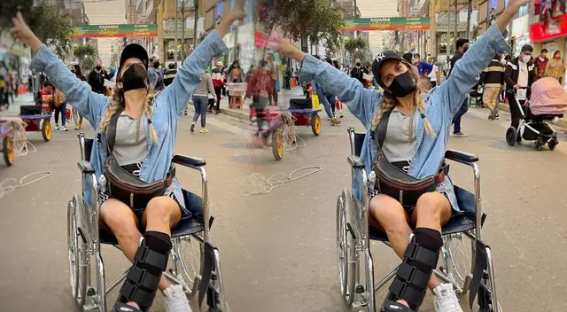 Alejandra Baigorria muestra el progreso de su operación al pie. Alejandra Baigorria muestra el progreso de su operación al pie.