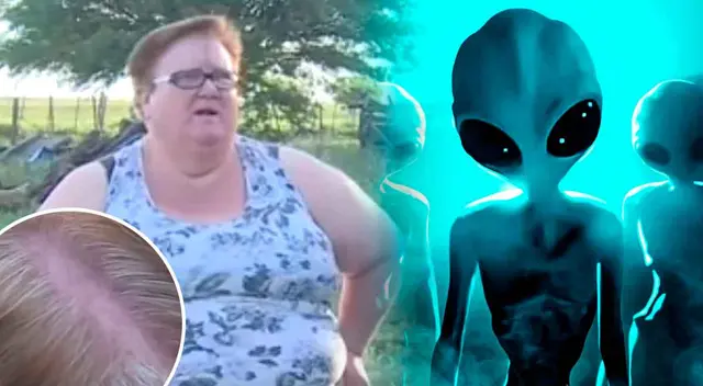 Irma Rick contó que los extraterrestres le abrieron la cabeza para estudiar su cerebro, por eso presenta un corte en el cráneo.