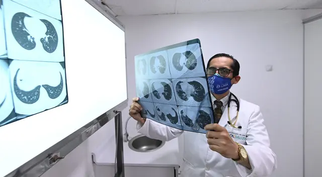 Un resfrío en niños puede durar entre 3 y 5 días, si empeora podría derivar a una neumonía.