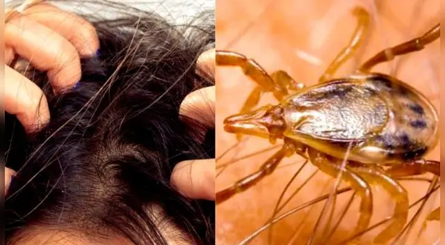 Soñar con piojos no refleja un buen augurio en tu vida.