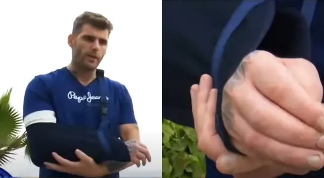 Greg Michel viene recuperándose tras el aparatoso accidente que vivió en Tarapoto y dio a conocer que necesita costosa cirugía para recobrar la movilidad completa en su mano.