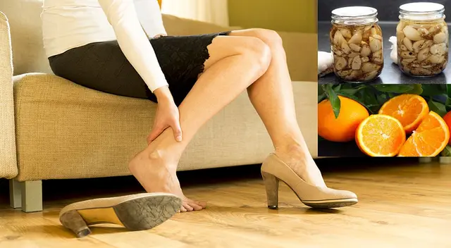 El ajo y la naranja forman un remedio casero que ayuda a atenuar las varices.