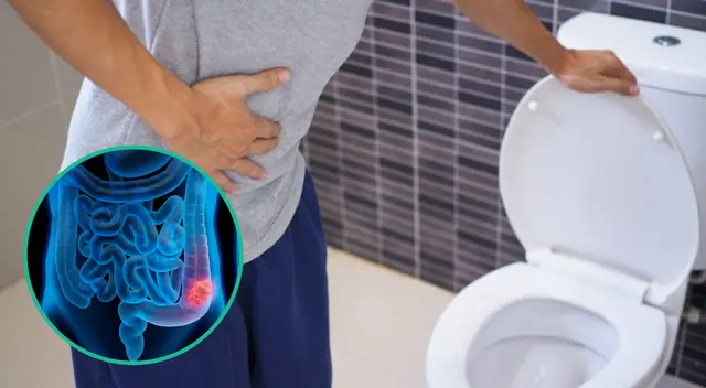 Un signo pueden ser cambios en los hábitos intestinales como el estreñimiento. Un signo pueden ser cambios en los hábitos intestinales como el estreñimiento.