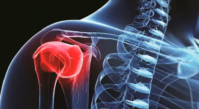 Síntomas del cáncer de huesos Síntomas del cáncer de huesos