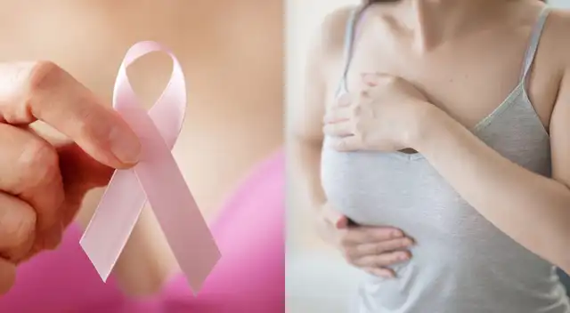 Suele aparecer en mujeres entre los 35 a 50 años.