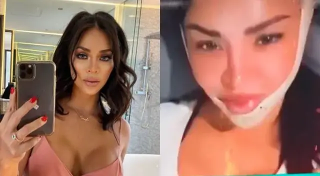 Sheyla Rojas aseguró que se hizo un procedimiento llamado 'body tight' y que tuvo efectos secundarios por viajar tan pronto después de hacérselo.