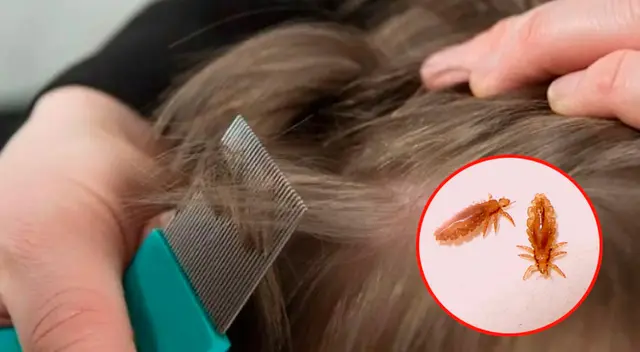 Soñar con piojos en la cabeza de mi hija.