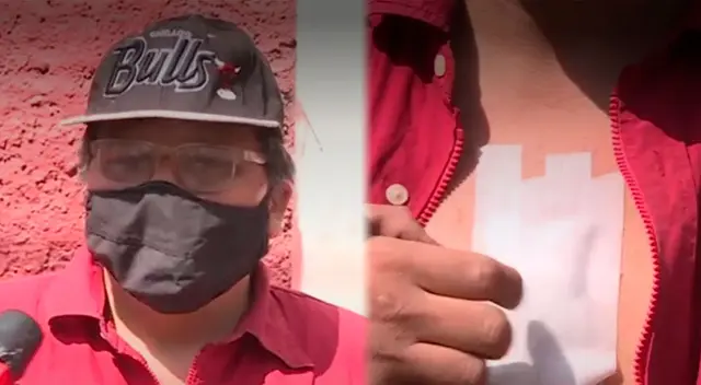 El reciclador recibió 6 puntos de satura en el pecho. El reciclador recibió 6 puntos de satura en el pecho.