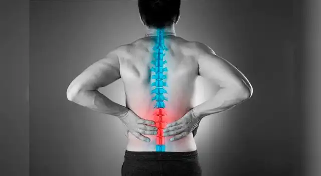 Un dolor lumbar podría causarte una discapacidad.