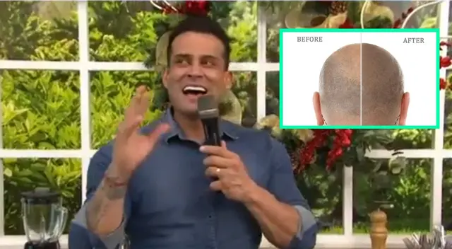 Christian Domínguez dio a conocer EN VIVO que en enero estaría acudiendo al doctor, y se mostró emocionado al preguntar por los detalles del procedimiento. Christian Domínguez dio a conocer EN VIVO que en enero estaría acudiendo al doctor, y se mostró emocionado al preguntar por los detalles del procedimiento.