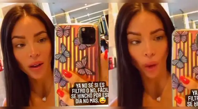 Sheyla Rojas luce con facciones raras luego de que sus labios incrementaran de tamaño.