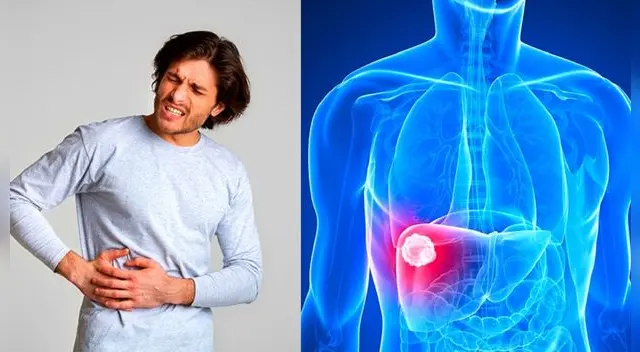 Si tienes algunos de estos síntomas debes acudir al médico para hacerlos examenes de descarte. Si tienes algunos de estos síntomas debes acudir al médico para hacerlos examenes de descarte.