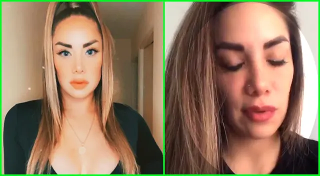 Grasse Becerra tras ser intervenida: Aún sigo en shock.