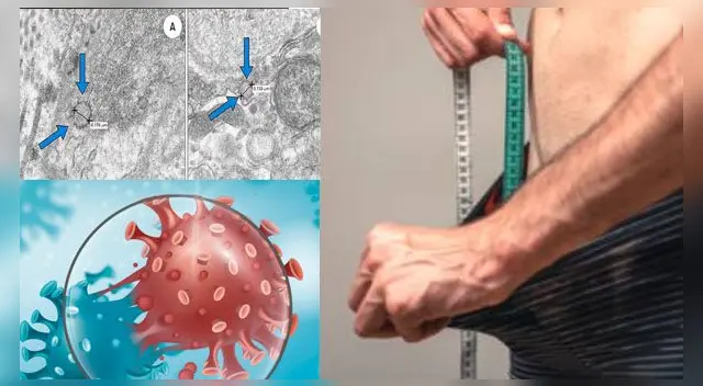 ¿Qué dicen los especialistas sobre el caso? Te lo decimos en la siguiente nota.