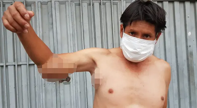 Señor sufre con los dos tumores instalados en su organismo.