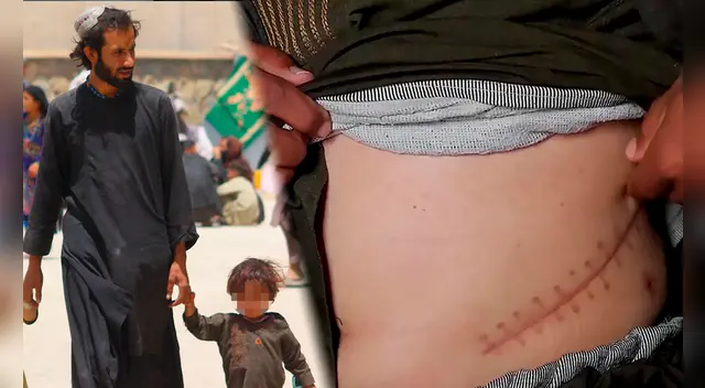 Muchas personas de escasos recursos venden sus riñones en Afganistán. Foto: composición/DW-Unicef Muchas personas de escasos recursos venden sus riñones en Afganistán. Foto: composición/DW-Unicef