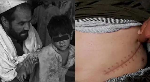 En Afganistán venden hasta sus órganos vitales para alimentar a su familia ante la crisis que vive el país.