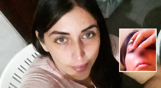 Claudia no cuenta con su cartílago y los medicamentos que le inyectaban para tratarla le ocasionaron otros problemas de salud. Claudia no cuenta con su cartílago y los medicamentos que le inyectaban para tratarla le ocasionaron otros problemas de salud.