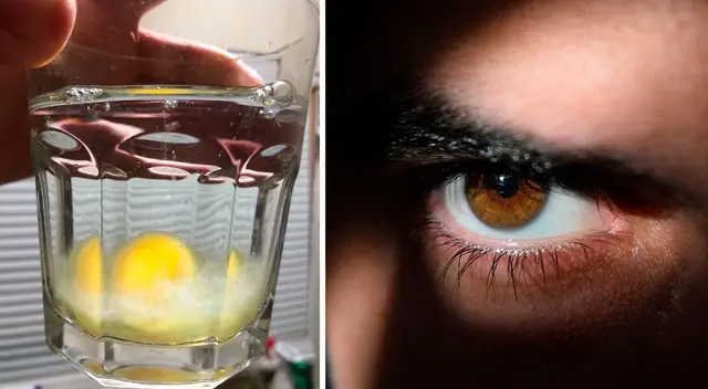 Aprende a diferenciar si tienes mal de ojo.