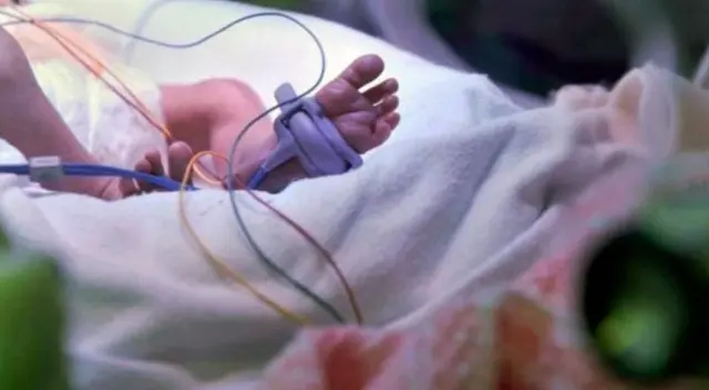 Menor de 3 meses llegó a tener 4 de hemoglobina (Foto referencial)