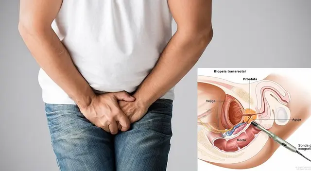 Si no te tratas a tiempo el cáncer de próstata puede diseminarse hacia otros órganos. Si no te tratas a tiempo el cáncer de próstata puede diseminarse hacia otros órganos.