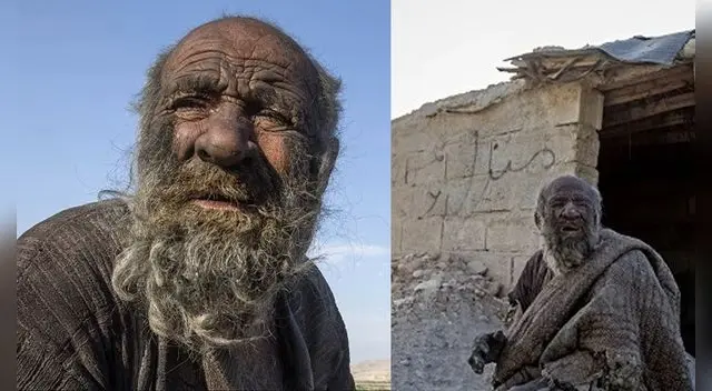 ¿Por qué está sano? Esto dicen los expertos sobre el caso de Amou Haji. ¿Por qué está sano? Esto dicen los expertos sobre el caso de Amou Haji.