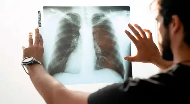 Conoce todos los detalles al infectarte del ómicron