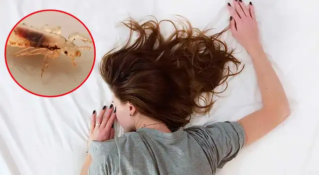 Significado de soñar con piojos en las pestañas.