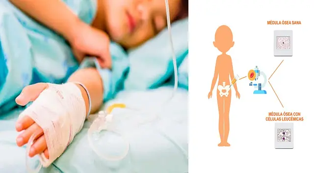 La leucemia es muy común en niños. La leucemia es muy común en niños.