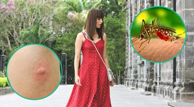 El sudor también es otro factor que atrae a los mosquitos.