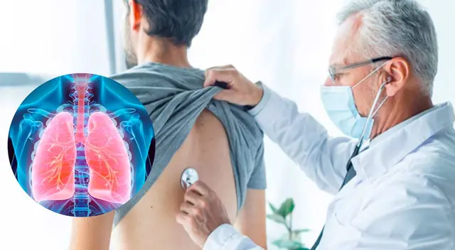 El ómicron deja secuelas en las vías respiratorias.