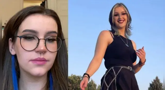 ¿A qué se debe esta rara condición? Aquí te lo explicamos. ¿A qué se debe esta rara condición? Aquí te lo explicamos.