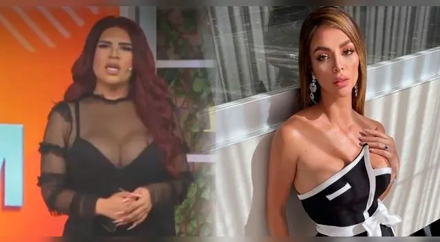 Ángela Curich defendió a su amiga y expuso que casi no se ha hecho operaciones.