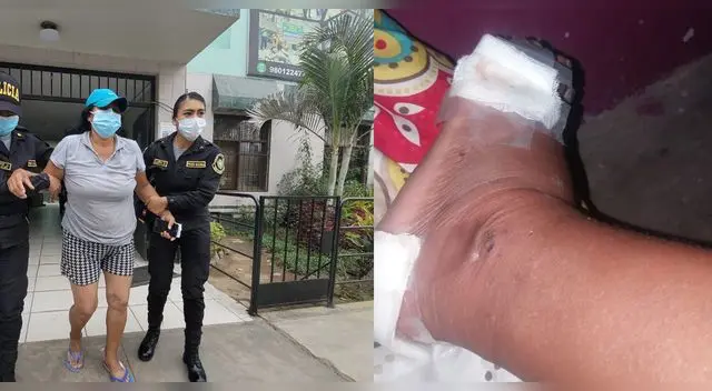 Madre de familia quedó gravemente herida tras frustrado intento de secuestro. Madre de familia quedó gravemente herida tras frustrado intento de secuestro.