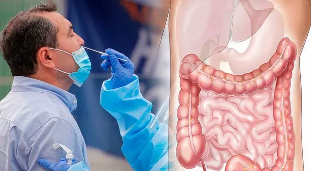 Secuelas del COVID-19