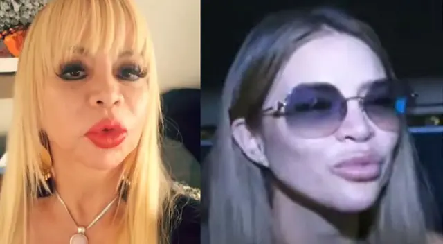 Susy Díaz le pide a Sheyla Rojas que no se preocupe por hinchazón en labios Susy Díaz le pide a Sheyla Rojas que no se preocupe por hinchazón en labios