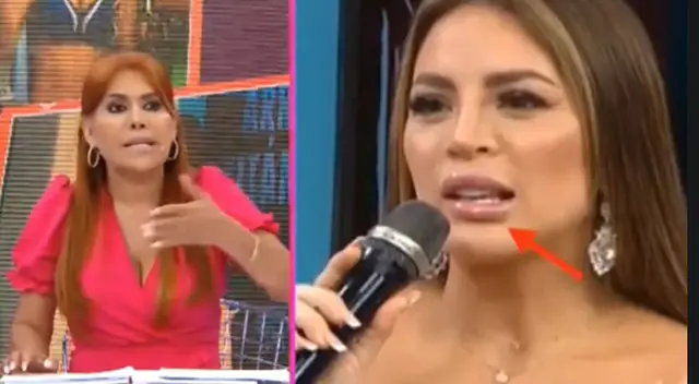 Magaly Medina aconseja a Sheyla Rojas demandar a cirujano.