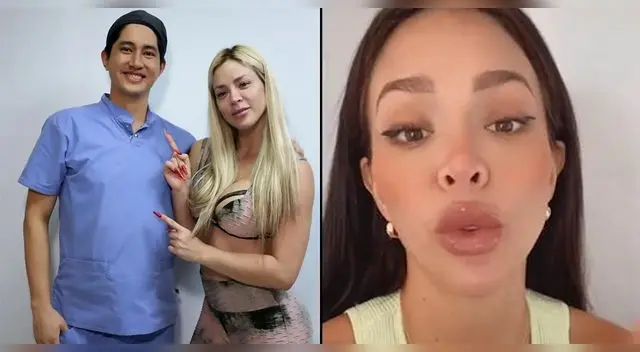 Cirujano explica por qué cara de Sheyla Rojas está afectada.