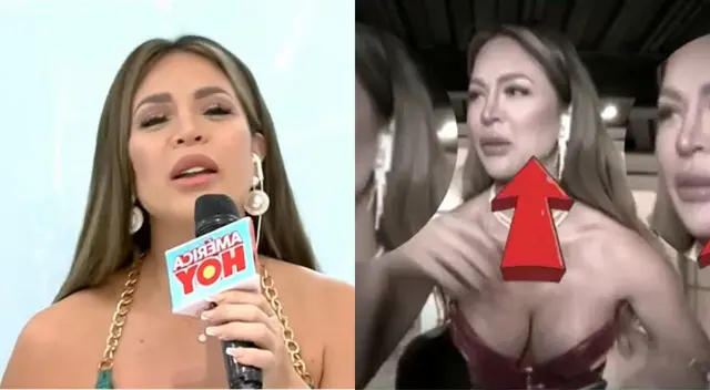 Sheyla Rojas evitó responsabilizar al doctor Fong por lo que le ocurrió en la cara, y aseguró que está en otro tema. ¿Qué pasó?