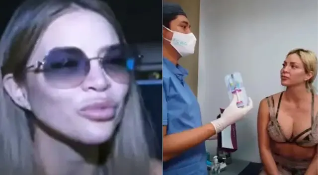 Doctor Fong culpa a Sheyla Rojas por parálisis facial de su rostro.