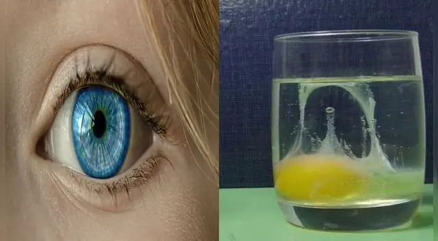 Mal de ojo: ¿Cómo se podrá erradicar este problema? Mal de ojo: ¿Cómo se podrá erradicar este problema?