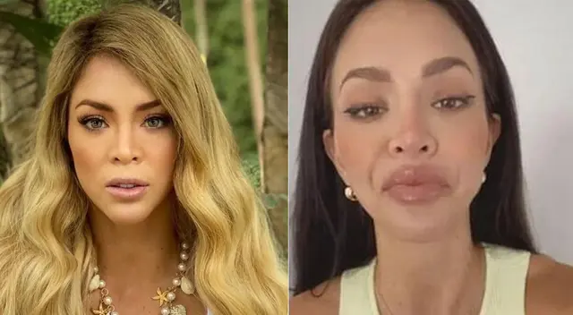 Sheyla Rojas explica en el Sketch de JB sobre el notable cambio en su rostro.